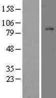 Plasminogen(PLG) (NM_000301) Human Tagged ORF Clone