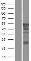 PBX4 (NM_025245) Human Tagged ORF Clone