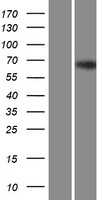 Zinc finger protein 668(ZNF668) (NM_024706) Human Tagged ORF Clone