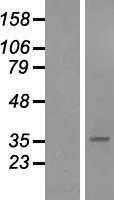 SFRP5 (NM_003015) Human Tagged ORF Clone