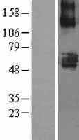 SLC22A7 (NM_006672) Human Tagged ORF Clone