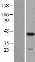 p38(MAPK14) (NM_001315) Human Tagged ORF Clone