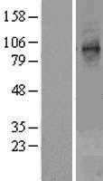 STT3A (NM_152713) Human Tagged ORF Clone