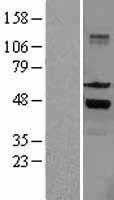 SKAP55(SKAP1) (NM_003726) Human Tagged ORF Clone