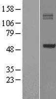 P4HA1 (NM_000917) Human Tagged ORF Clone