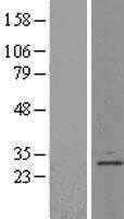DERL1 (NM_024295) Human Tagged ORF Clone