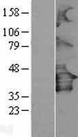 P2Y12(P2RY12) (NM_022788) Human Tagged ORF Clone