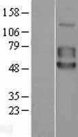 5T4(TPBG) (NM_006670) Human Tagged ORF Clone