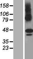 ZDHHC11 (NM_024786) Human Tagged ORF Clone