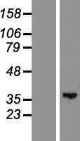 GLYATL2 (NM_145016) Human Tagged ORF Clone