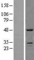 SOSTDC1 (NM_015464) Human Tagged ORF Clone