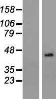 NSUN3 (NM_022072) Human Tagged ORF Clone