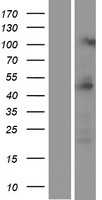 PRMT2 (NM_206962) Human Tagged ORF Clone