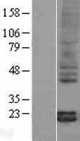 Pleiotrophin(PTN) (NM_002825) Human Tagged ORF Clone