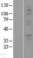 P2Y6(P2RY6) (NM_176797) Human Tagged ORF Clone