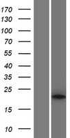 PLA2G12A (NM_030821) Human Tagged ORF Clone