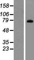 PADI1 (NM_013358) Human Tagged ORF Clone