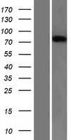 Semaphorin 3B(SEMA3B) (NM_004636) Human Tagged ORF Clone