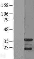 p35(CDK5R1) (NM_003885) Human Tagged ORF Clone