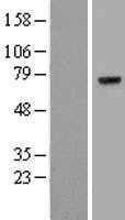 Prothrombin(F2) (NM_000506) Human Tagged ORF Clone