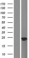 Gastrokine 1(GKN1) (NM_019617) Human Tagged ORF Clone