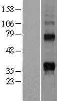 RANKL(TNFSF11) (NM_003701) Human Tagged ORF Clone