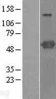 PSTPIP1 (NM_003978) Human Tagged ORF Clone