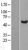 DDX6 (NM_004397) Human Tagged ORF Clone