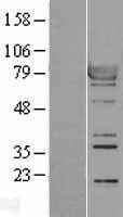 RSK1 p90(RPS6KA1) (NM_002953) Human Tagged ORF Clone