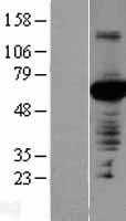 PVRL4(NECTIN4) (NM_030916) Human Tagged ORF Clone