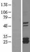 Mitochondrial Ferritin(FTMT) (NM_177478) Human Tagged ORF Clone