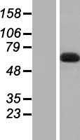 DBR1 (NM_016216) Human Tagged ORF Clone