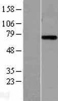 Plasma Kallikrein 1B(KLKB1) (NM_000892) Human Tagged ORF Clone