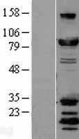 DRP1(DNM1L) (NM_012062) Human Tagged ORF Clone