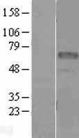 PLD4 (NM_138790) Human Tagged ORF Clone