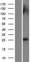RAB12 (NM_001025300) Human Tagged ORF Clone