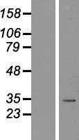 Nkx2.2(NKX2-2) (NM_002509) Human Tagged ORF Clone