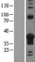 DHLAG(CD74) (NM_001025159) Human Tagged ORF Clone