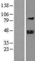DNAJB11 (NM_016306) Human Tagged ORF Clone
