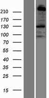 Plexin B1(PLXNB1) (NM_002673) Human Tagged ORF Clone
