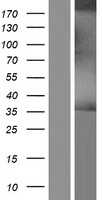DHLAG(CD74) (NM_004355) Human Tagged ORF Clone