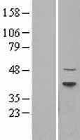 Dnmt2(TRDMT1) (NM_004412) Human Tagged ORF Clone