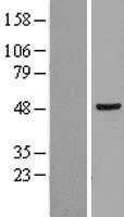 hHR23b(RAD23B) (NM_002874) Human Tagged ORF Clone