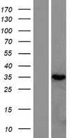 RNASEH2B (NM_024570) Human Tagged ORF Clone