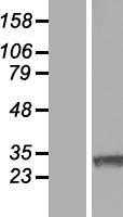 RNF138 (NM_016271) Human Tagged ORF Clone