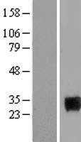 Homeobox protein SIX6(SIX6) (NM_007374) Human Tagged ORF Clone
