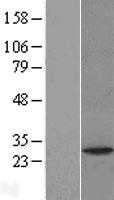 PAFAH1B2 (NM_002572) Human Tagged ORF Clone