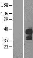 DR5(TNFRSF10B) (NM_003842) Human Tagged ORF Clone
