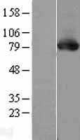 PKC delta(PRKCD) (NM_212539) Human Tagged ORF Clone