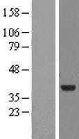 NMNAT2 (NM_170706) Human Tagged ORF Clone